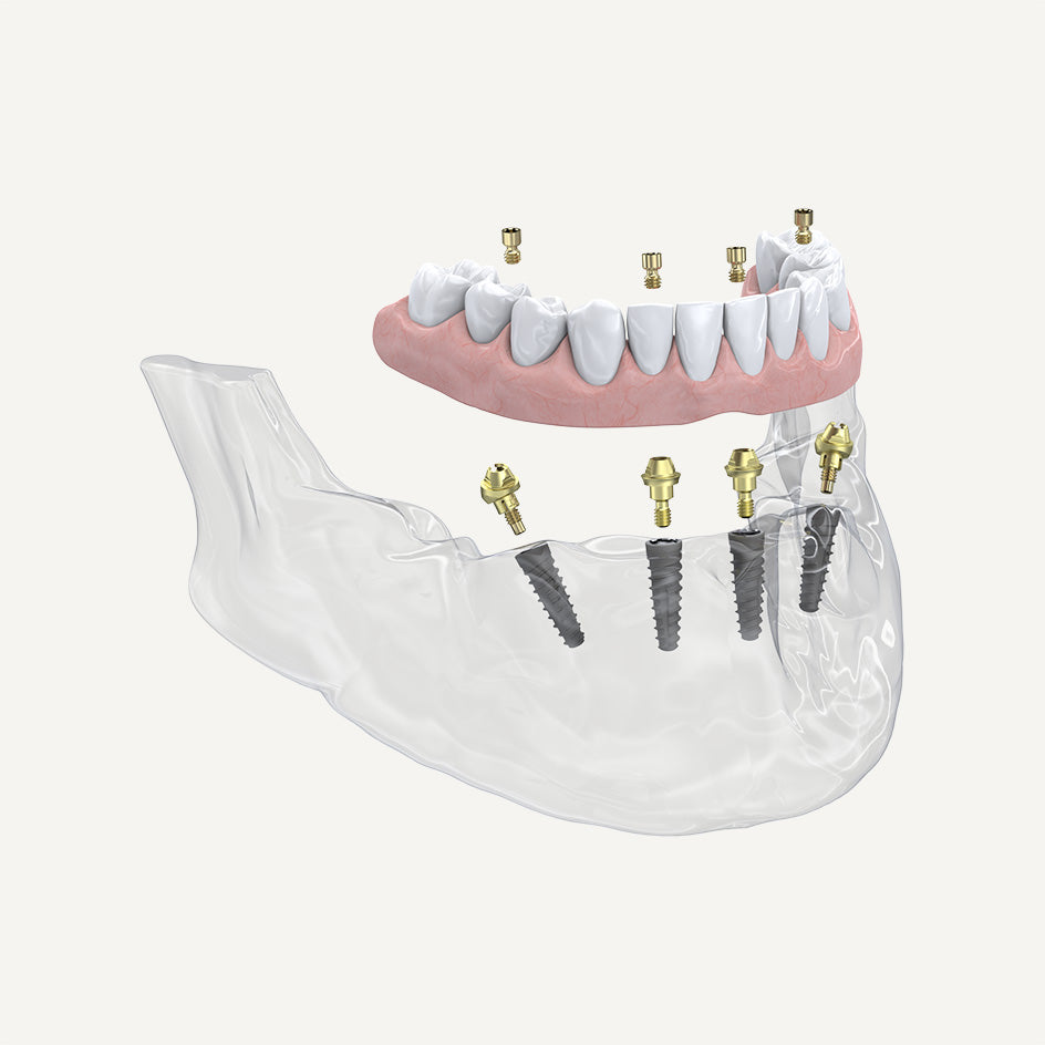 Multi-Unit Abutments